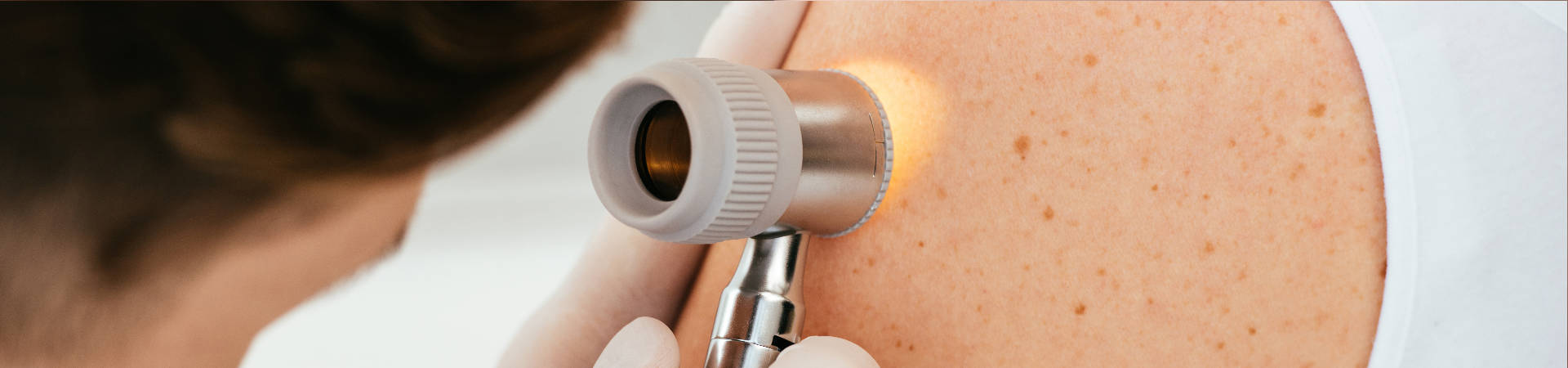 Dermatologist examining patient with skin disease